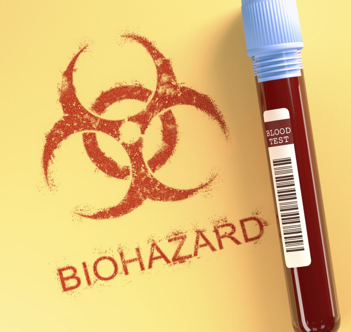 Can You Clean Biohazards Yourself in Bakersfield, CA?