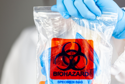 What to Expect During a Biohazard Cleanup: FAQs for Chicagoland Property Owners