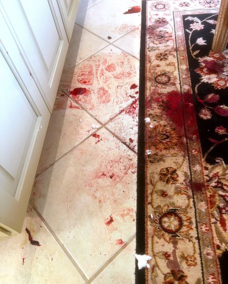 Oriental Rug and Tile floor with fresh biohazard blood stains on it.