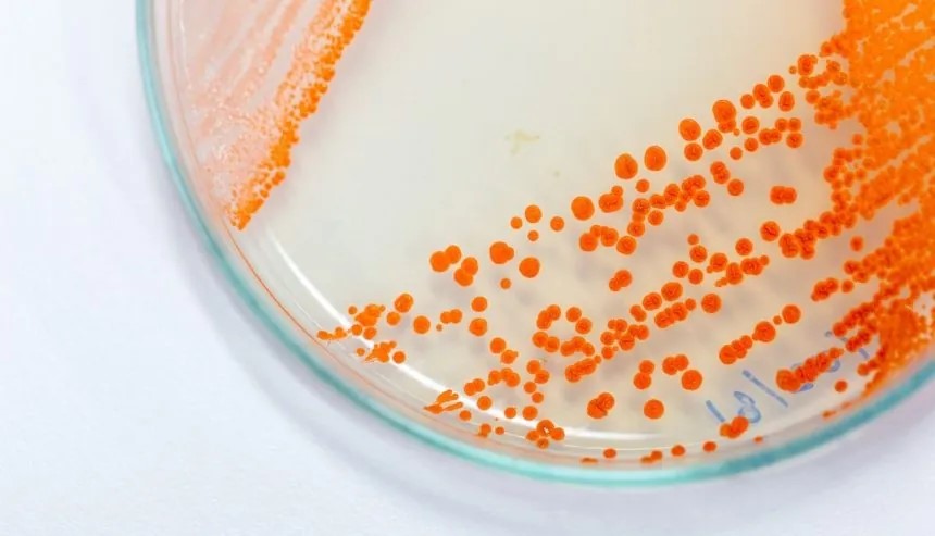 Pink mold growing in petri dish