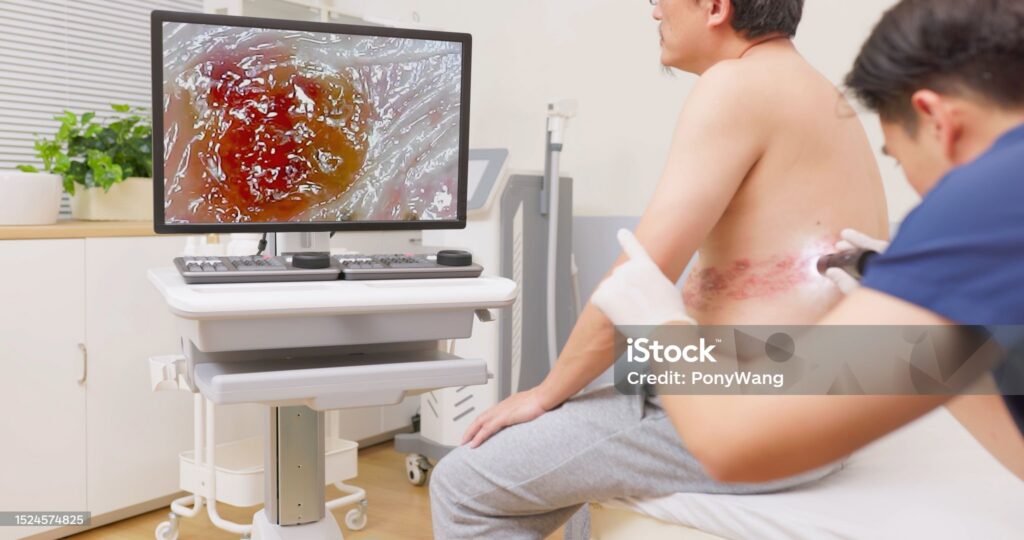 Mold and Shingles: Can Mold Cause Shingles in 2024?