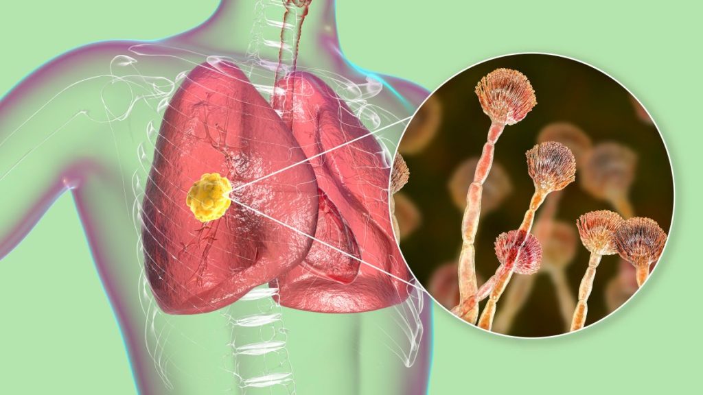 mold health risks