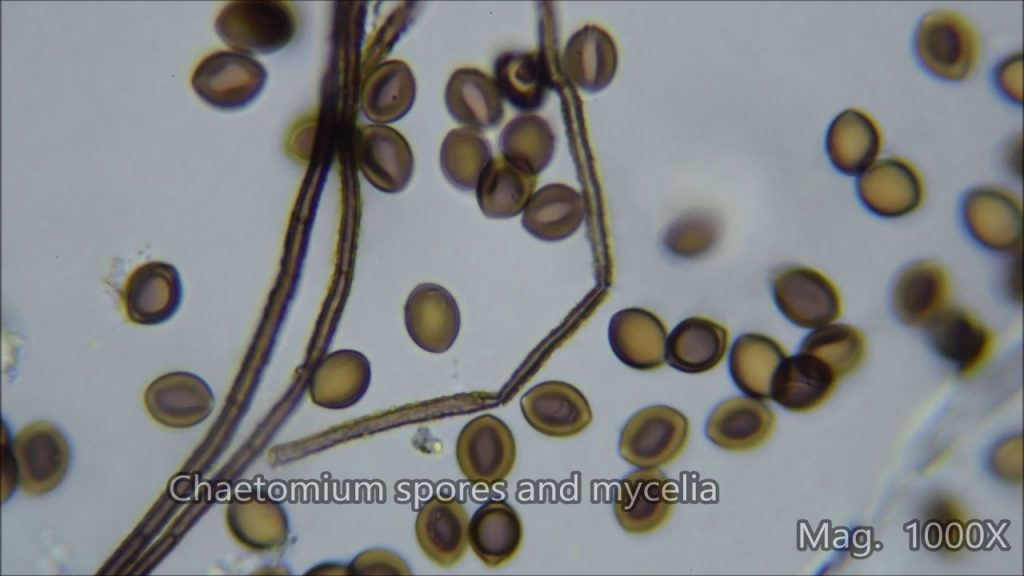 Airborne mold spores magnified under a microscope
