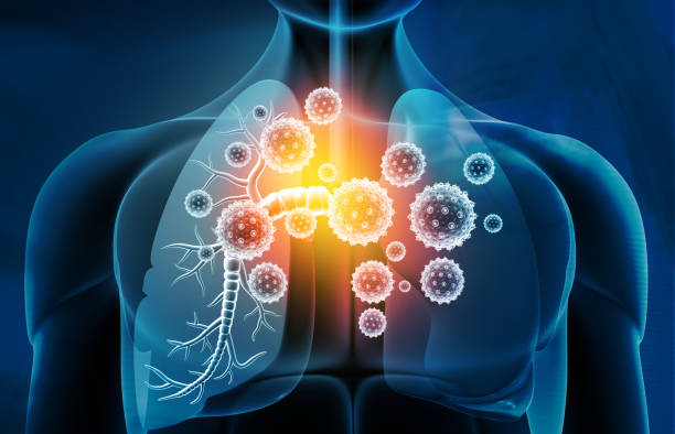 Long Term Mold Exposure Symptom #1: Persistent Respiratory Decline