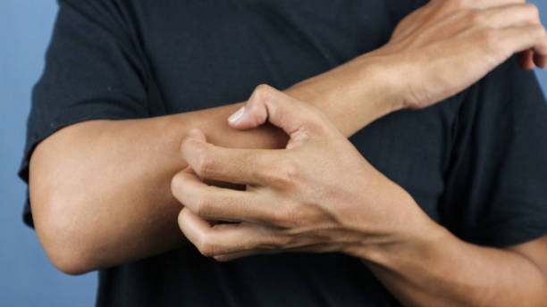Is White Mold Dangerous on Skin