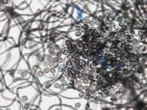 prevent black mold in Tacoma