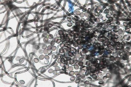 prevent black mold in Tacoma