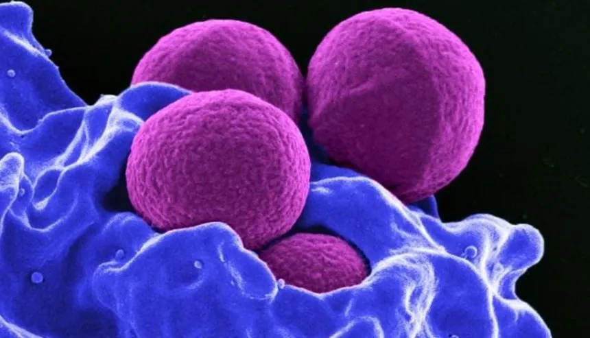 MRSA bacterium