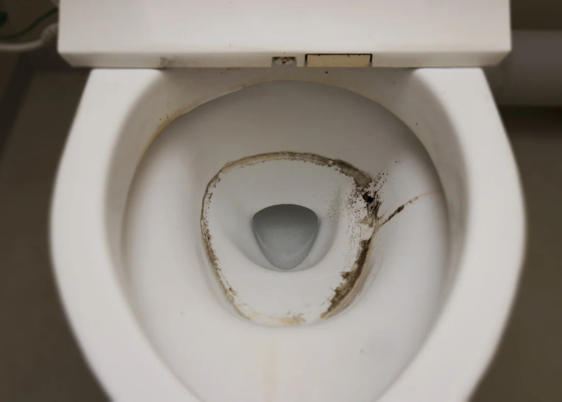 Mold in Toilet: How to Remove Mold in Toilet