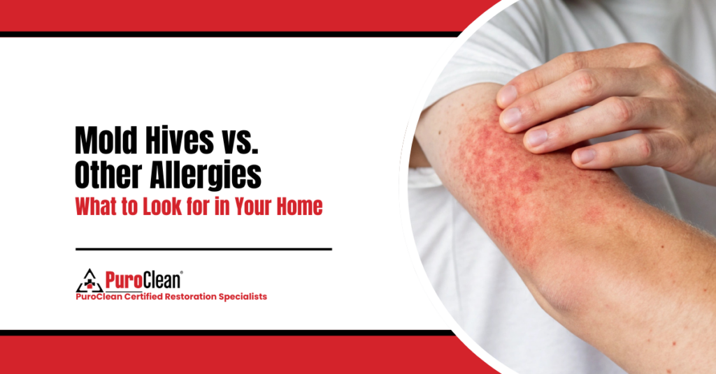 Mold Hives vs. Other Allergies What to Look for in Your Home