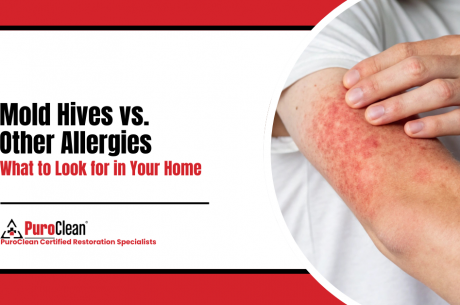 Mold Hives vs. Other Allergies What to Look for in Your Home